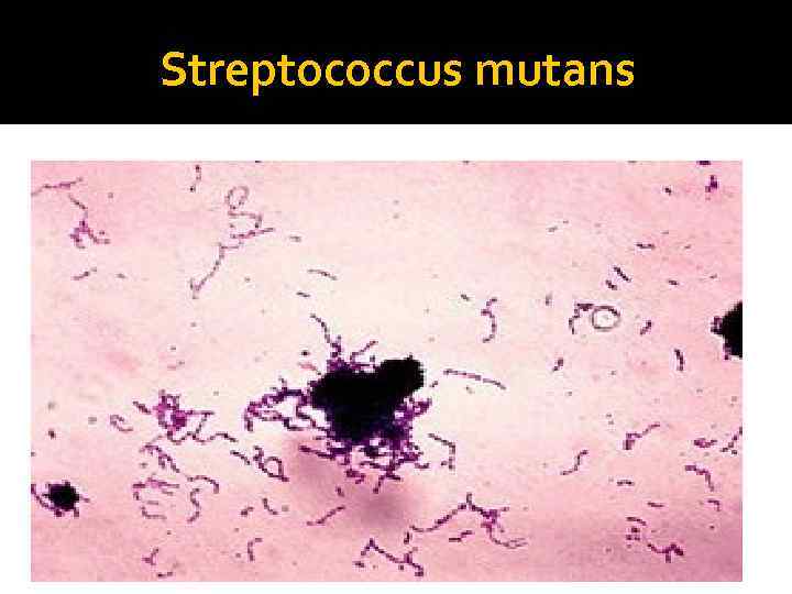 Streptococcus mutans 