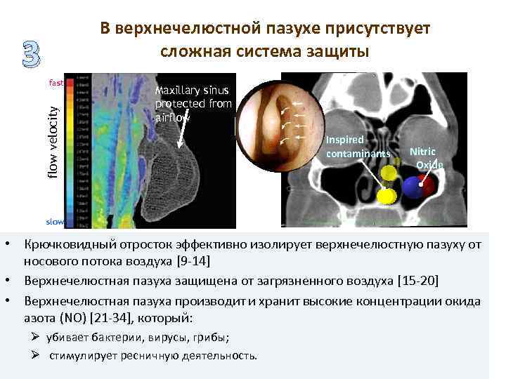 fast flow velocity 3 В верхнечелюстной пазухе присутствует сложная система защиты Maxillary sinus protected