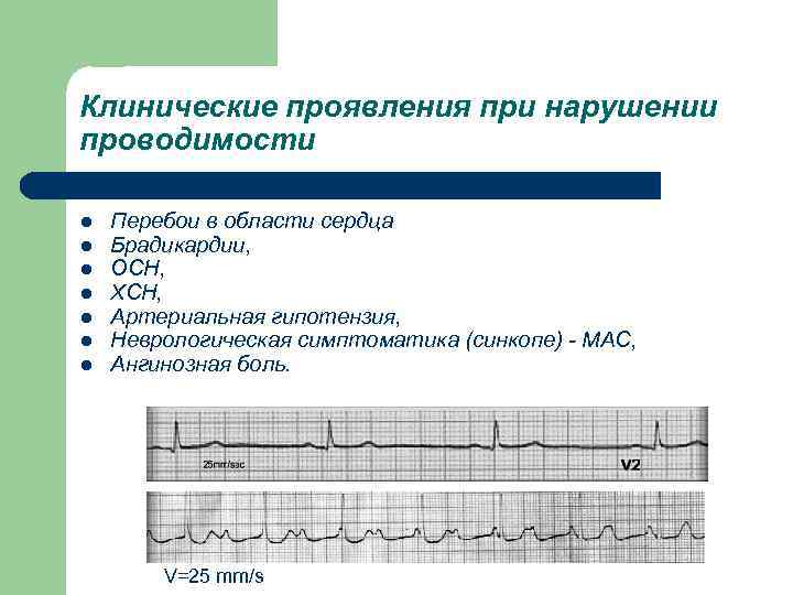 Клинические проявления при нарушении проводимости l l l l Перебои в области сердца Брадикардии,
