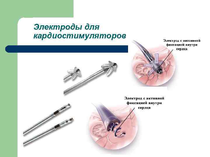 Электроды для кардиостимуляторов 