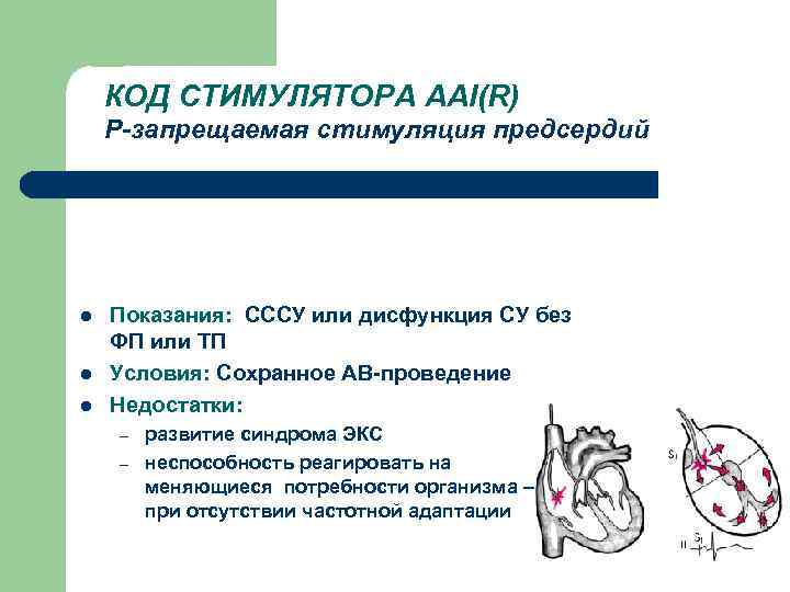 КОД СТИМУЛЯТОРА ААI(R) Р-запрещаемая стимуляция предсердий l l l Показания: СССУ или дисфункция СУ