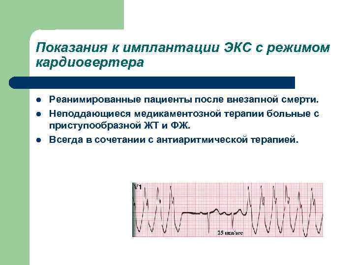 Показания к имплантации ЭКС с режимом кардиовертера l l l Реанимированные пациенты после внезапной
