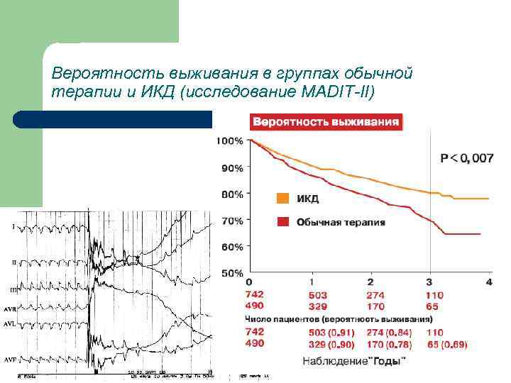 Вероятность выживания в группах обычной терапии и ИКД (исследование MADIТ-II) 