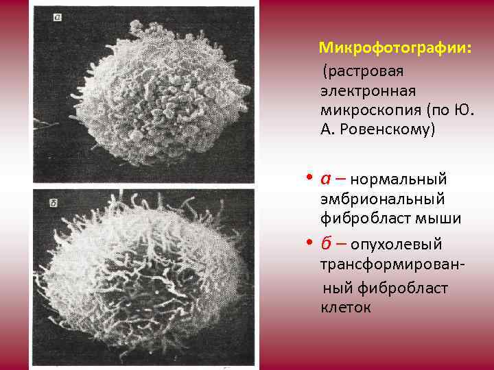  Микрофотографии: (растровая электронная микроскопия (по Ю. А. Ровенскому) • а – нормальный эмбриональный