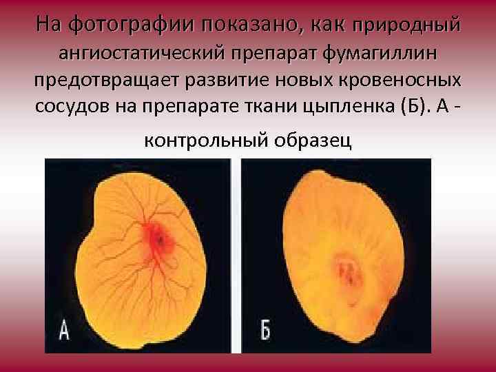 На фотографии показано, как природный ангиостатический препарат фумагиллин предотвращает развитие новых кровеносных сосудов на