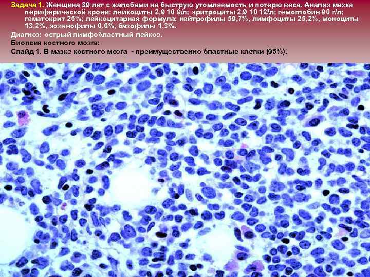 Задача 1. Женщина 39 лет с жалобами на быструю утомляемость и потерю веса. Анализ