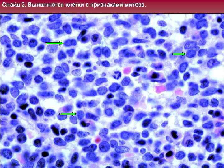 Слайд 2. Выявляются клетки с признаками митоза. 