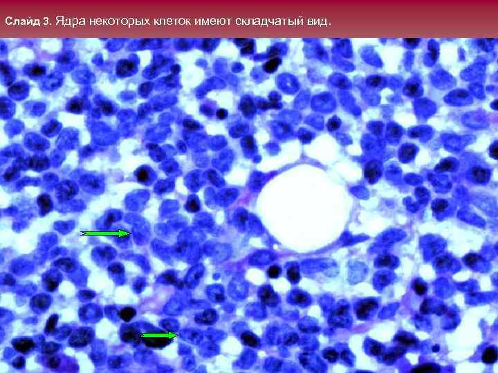 Слайд 3. Ядра некоторых клеток имеют складчатый вид. 