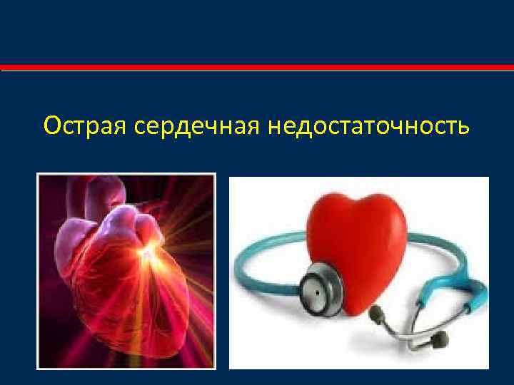 Острая сердечная недостаточность 