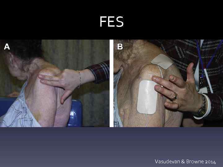 FES Vasudevan & Browne 2014 