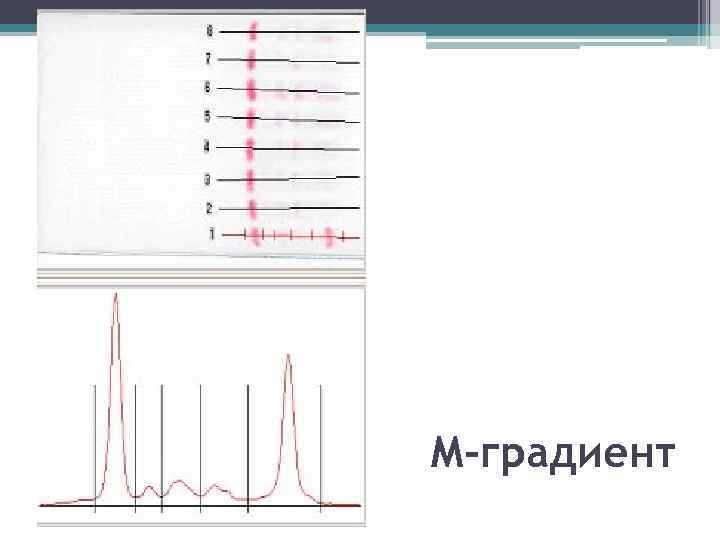 М градиент инвитро. М градиент. М-градиент в крови. Электрофорез м градиент. М градиент норма.