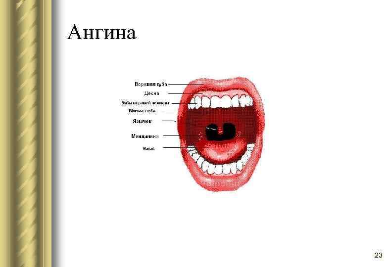 Ангина 23 