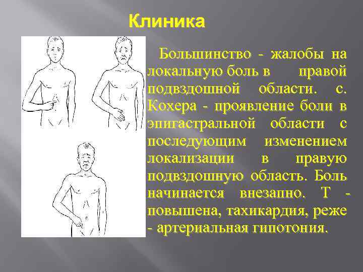 Клиника Большинство - жалобы на локальную боль в правой подвздошной области. с. Кохера -