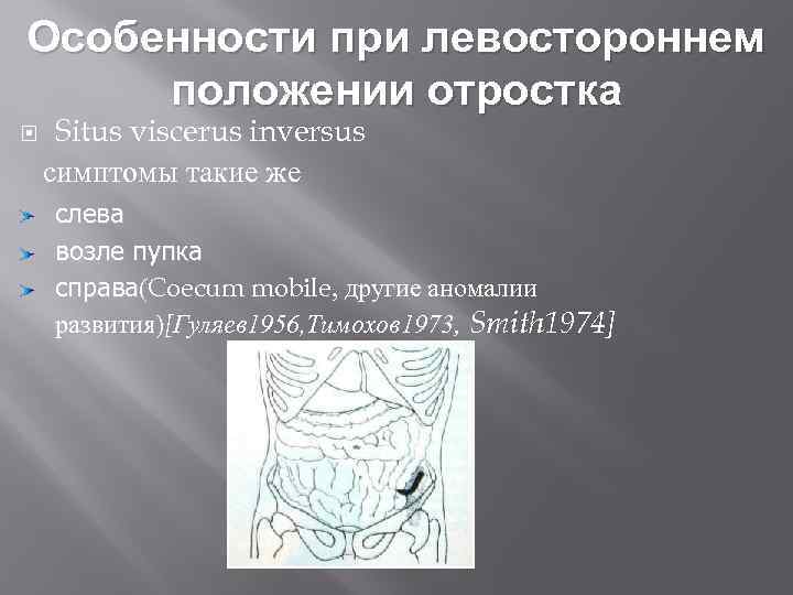 Особенности при левостороннем положении отростка Situs viscerus inversus симптомы такие же слева возле пупка