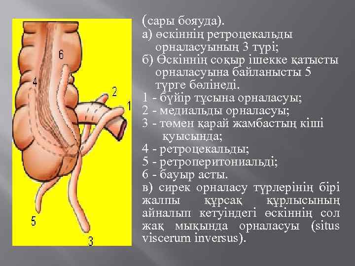 (сары бояуда). а) өскіннің ретроцекальды орналасуының 3 түрі; б) Өскіннің соқыр ішекке қатысты орналасуына