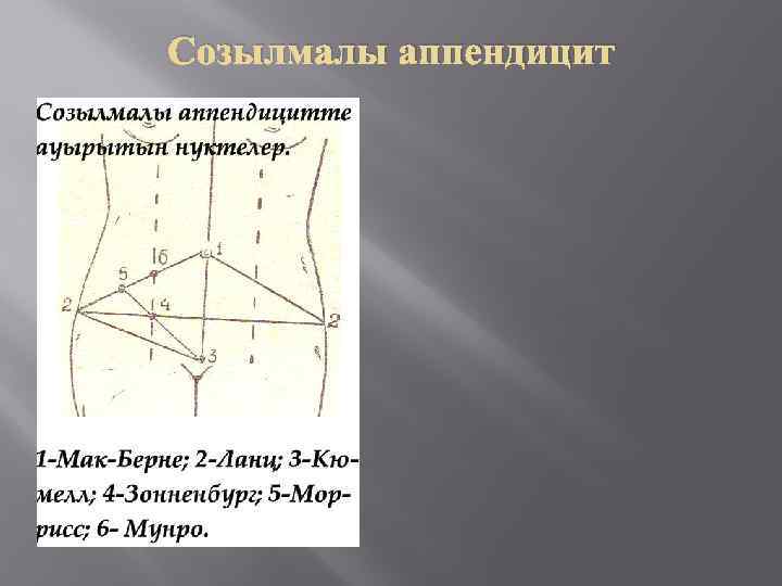 Созылмалы аппендицит 