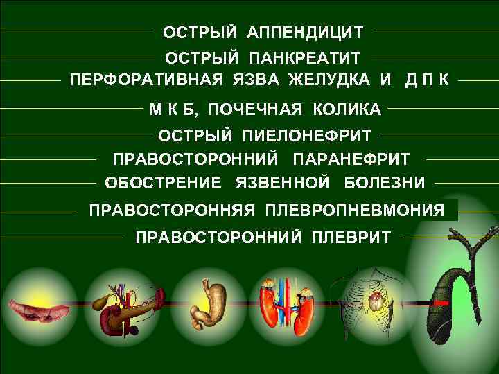 ОСТРЫЙ АППЕНДИЦИТ ОСТРЫЙ ПАНКРЕАТИТ ПЕРФОРАТИВНАЯ ЯЗВА ЖЕЛУДКА И Д П К М К Б,