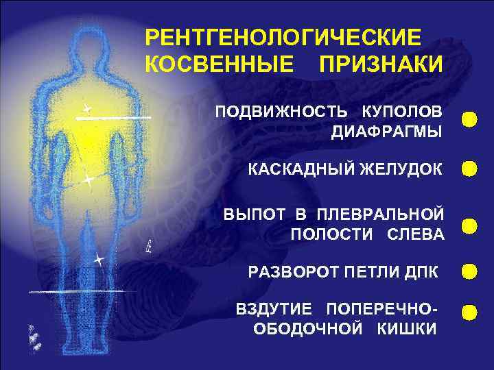РЕНТГЕНОЛОГИЧЕСКИЕ КОСВЕННЫЕ ПРИЗНАКИ ПОДВИЖНОСТЬ КУПОЛОВ ДИАФРАГМЫ КАСКАДНЫЙ ЖЕЛУДОК ВЫПОТ В ПЛЕВРАЛЬНОЙ ПОЛОСТИ СЛЕВА РАЗВОРОТ
