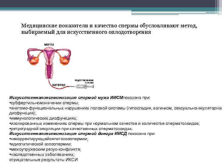 Медицинские показатели и качество спермы обусловливают метод, выбираемый для искусственного оплодотворения Искусственнаяинсеминизация спермой мужа