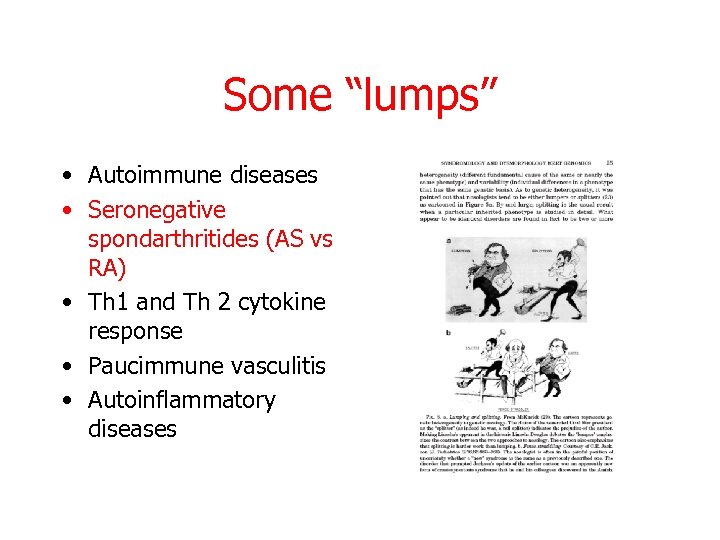 Some “lumps” • Autoimmune diseases • Seronegative spondarthritides (AS vs RA) • Th 1