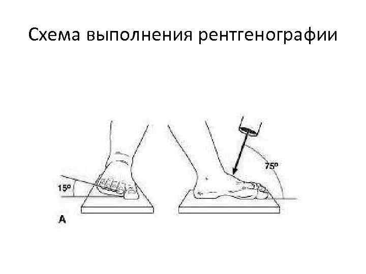 Схема выполнения рентгенографии 