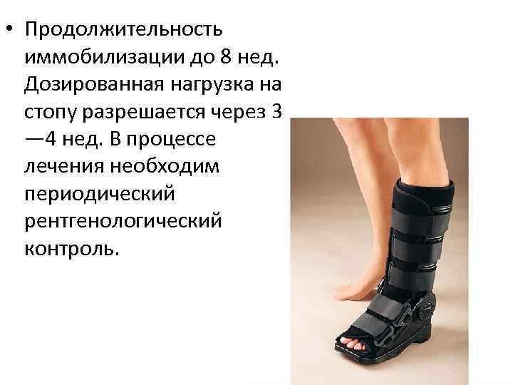  • Продолжительность иммобилизации до 8 нед. Дозированная нагрузка на стопу разрешается через 3