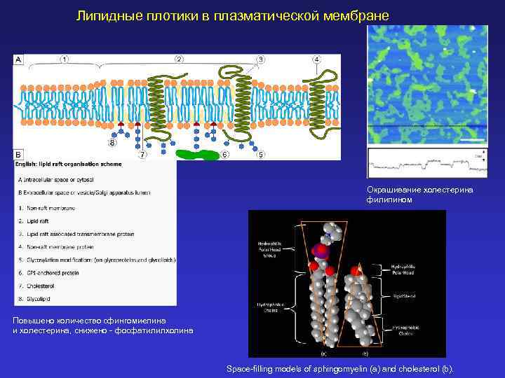 Липидные плотики в плазматической мембране Окрашивание холестерина филипином Повышено количество сфингомиелина и холестерина, снижено