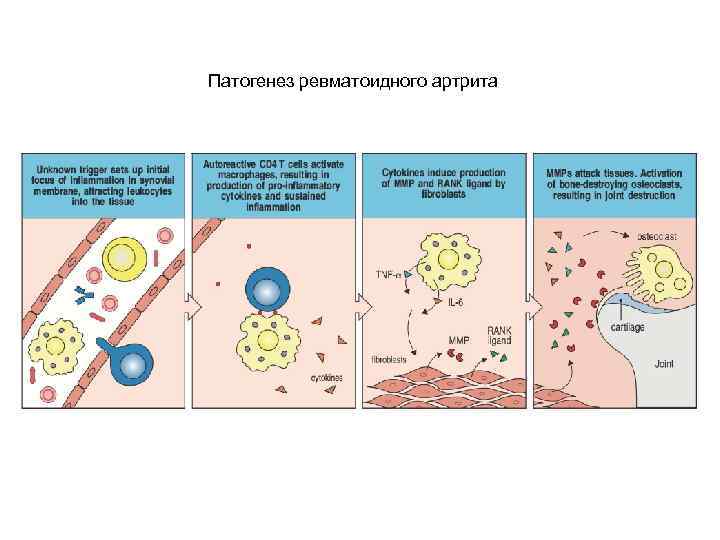 Патогенез ревматоидного артрита схема