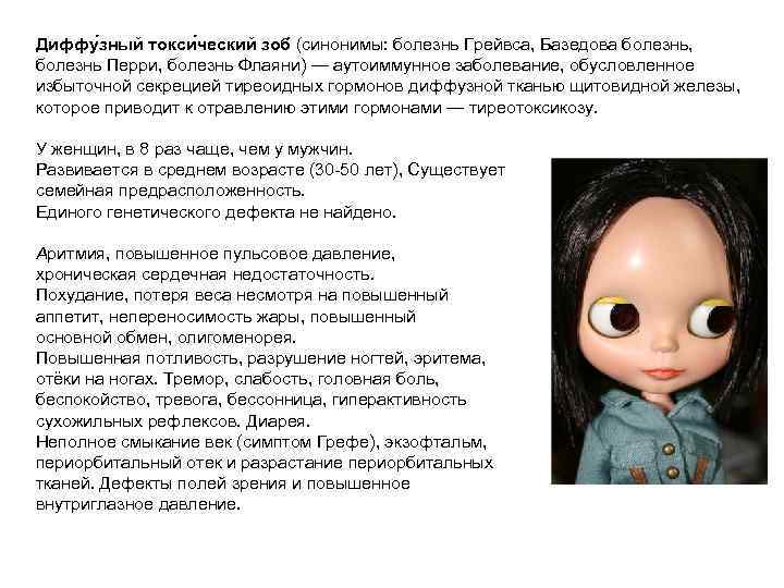 Диффу зный токси ческий зоб (синонимы: болезнь Грейвcа, Базедова болезнь, болезнь Перри, болезнь Флаяни)