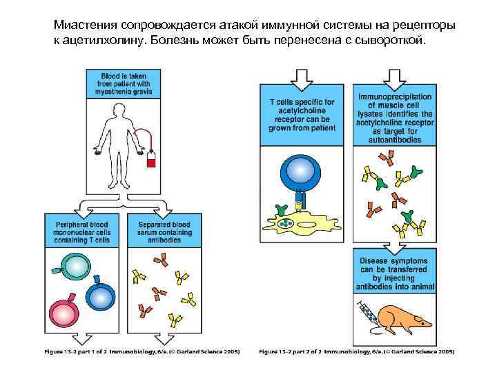 Миастения сопровождается атакой иммунной системы на рецепторы к ацетилхолину. Болезнь может быть перенесена с