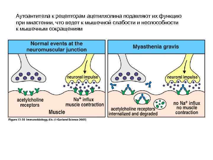 Аутоантитела к рецепторам ацетилхолина подавляют их функцию при миастении, что ведет к мышечной слабости