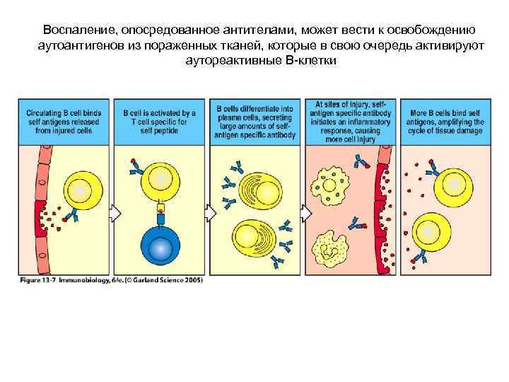 Воспаление, опосредованное антителами, может вести к освобождению аутоантигенов из пораженных тканей, которые в свою