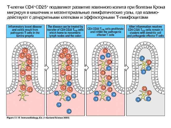 Т-клетки CD 4+CD 25+ подавляют развитие язвенного колита при болезни Крона мигрируя в кишечник