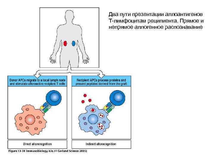 Два пути презентации аллоантигенов Т-лимфоцитам реципиента. Прямое и непрямое аллогенное распознавание 
