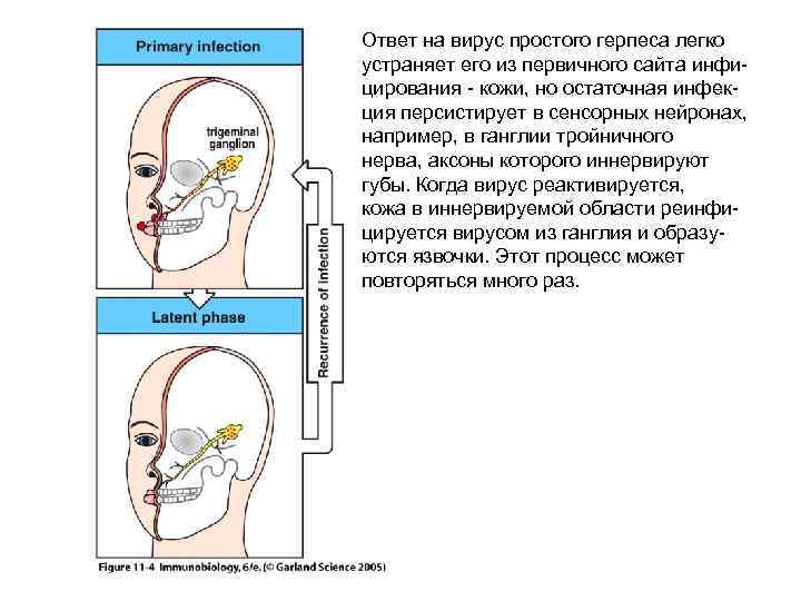 Ответ на вирус простого герпеса легко устраняет его из первичного сайта инфицирования - кожи,