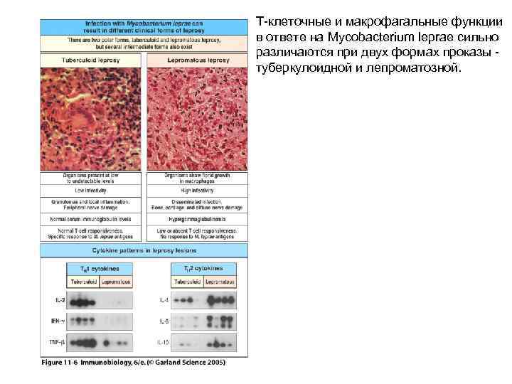 Т-клеточные и макрофагальные функции в ответе на Mycobacterium leprae сильно различаются при двух формах