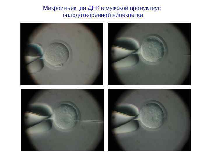 Микроинъекция ДНК в мужской пронуклеус оплодотворенной яйцеклетки 