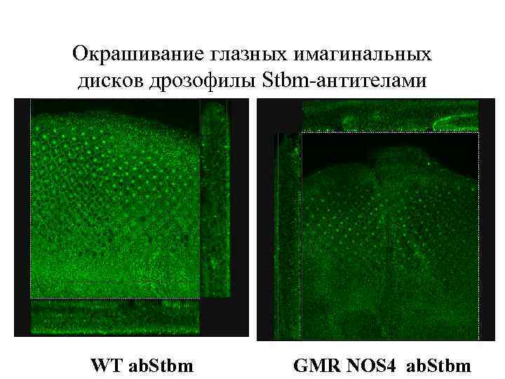 Окрашивание глазных имагинальных дисков дрозофилы Stbm-антителами WT ab. Stbm GMR NOS 4 ab. Stbm