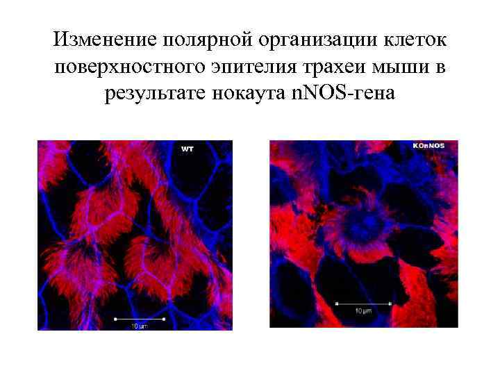 Изменение полярной организации клеток поверхностного эпителия трахеи мыши в результате нокаута n. NOS-гена 