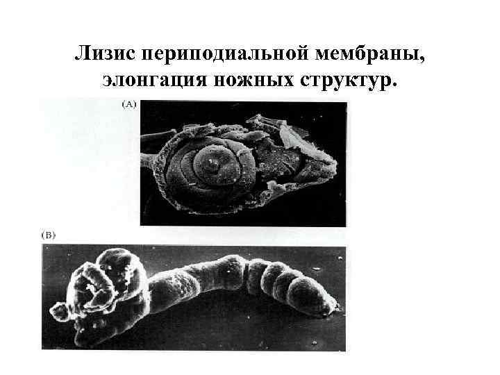 Лизис периподиальной мембраны, элонгация ножных структур. 