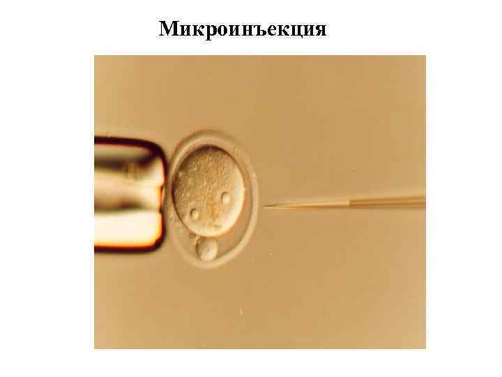 Микроинъекция 