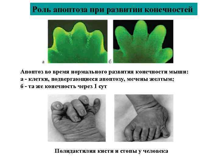 Роль апоптоза при развитии конечностей Апоптоз во время нормального развития конечности мыши: а -
