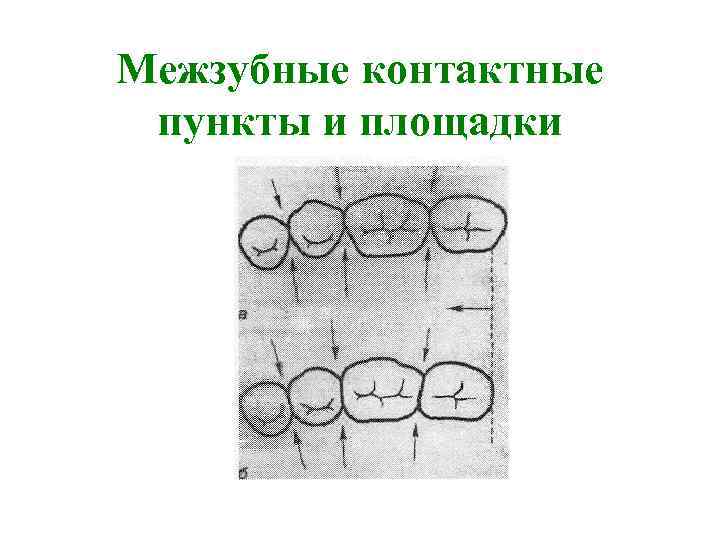 Контактный вид. Межзубные контактные пункты. Межзубные контактные пункты и площадки. Контактный пункт в стоматологии. Плоскостной контактный пункт.