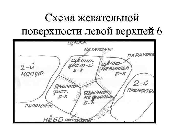 Схема жевательной поверхности левой верхней 6 