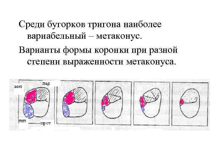 Среди бугорков тригона наиболее вариабельный – метаконус. Варианты формы коронки при разной степени выраженности