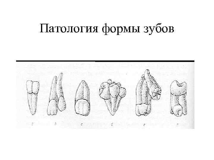 Патология формы зубов 