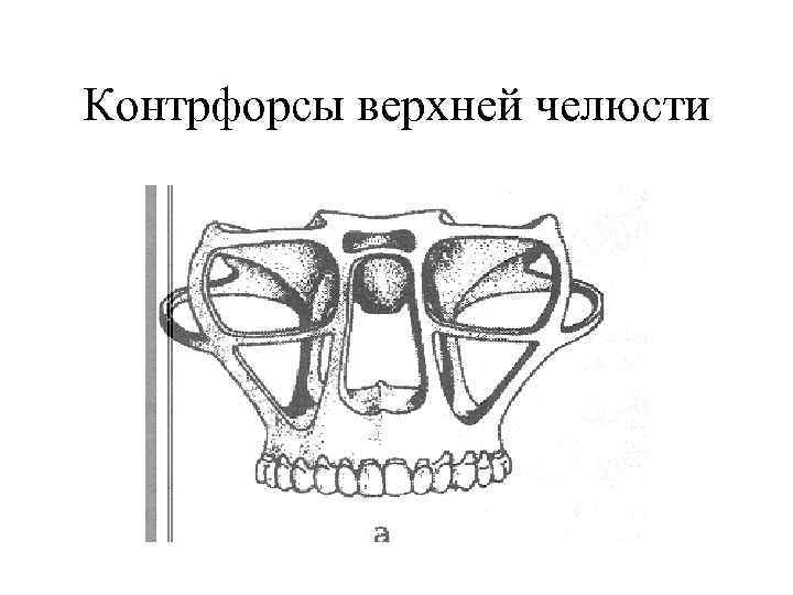 Контрфорсы верхней челюсти 