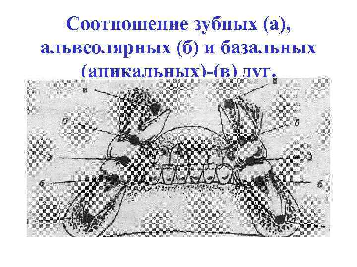 Соотношение зубных (а), альвеолярных (б) и базальных (апикальных)-(в) дуг. 