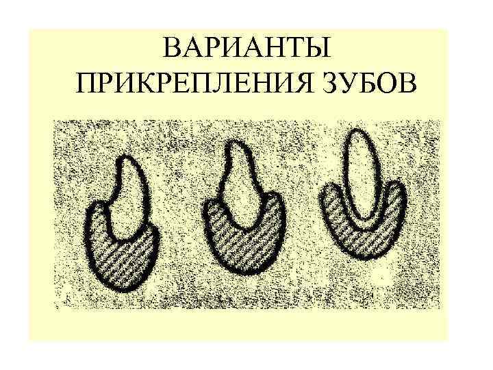 ВАРИАНТЫ ПРИКРЕПЛЕНИЯ ЗУБОВ 