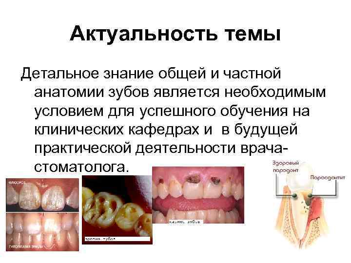 Актуальность темы Детальное знание общей и частной анатомии зубов является необходимым условием для успешного